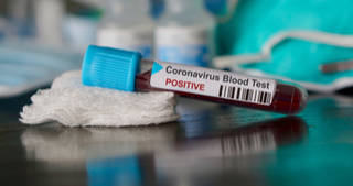 As of February, the recovery rate for Covid-19 climbed to 46% of all confirmed cases compared to 24% a week earlier